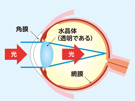 正常な眼